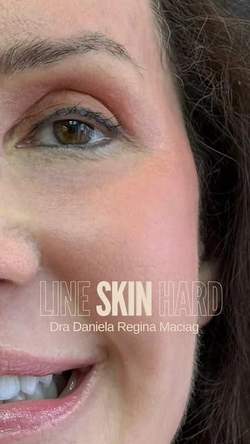 Line Skin Hard: publicação da Clínica Daniella Maciag