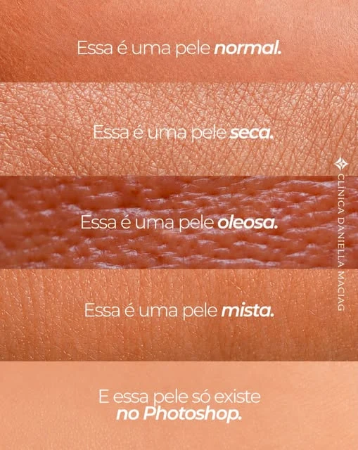 Cada pele tem suas características: publicação da Clínica Daniella Maciag